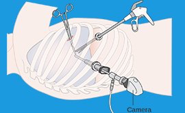 Chest Specialist in Delhi